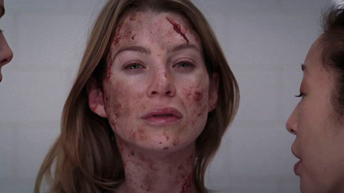 Grey’s Anatomy 2×17